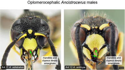 Oplomerocephaly